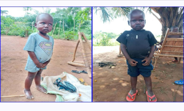 L’histoire de MASINI, guéri de la malnutrition